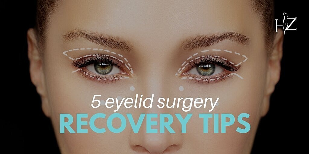 5 Eyelid Surgery Recovery Tips