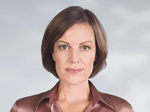 sculptra patient after photo 3