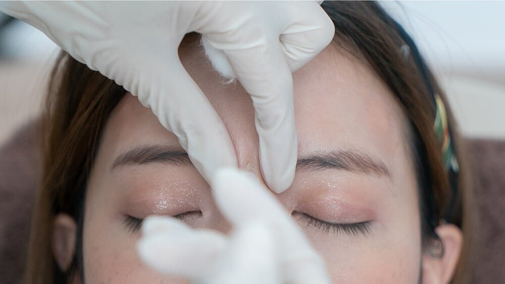 Dermal Fillers: Not Just For Your Lips