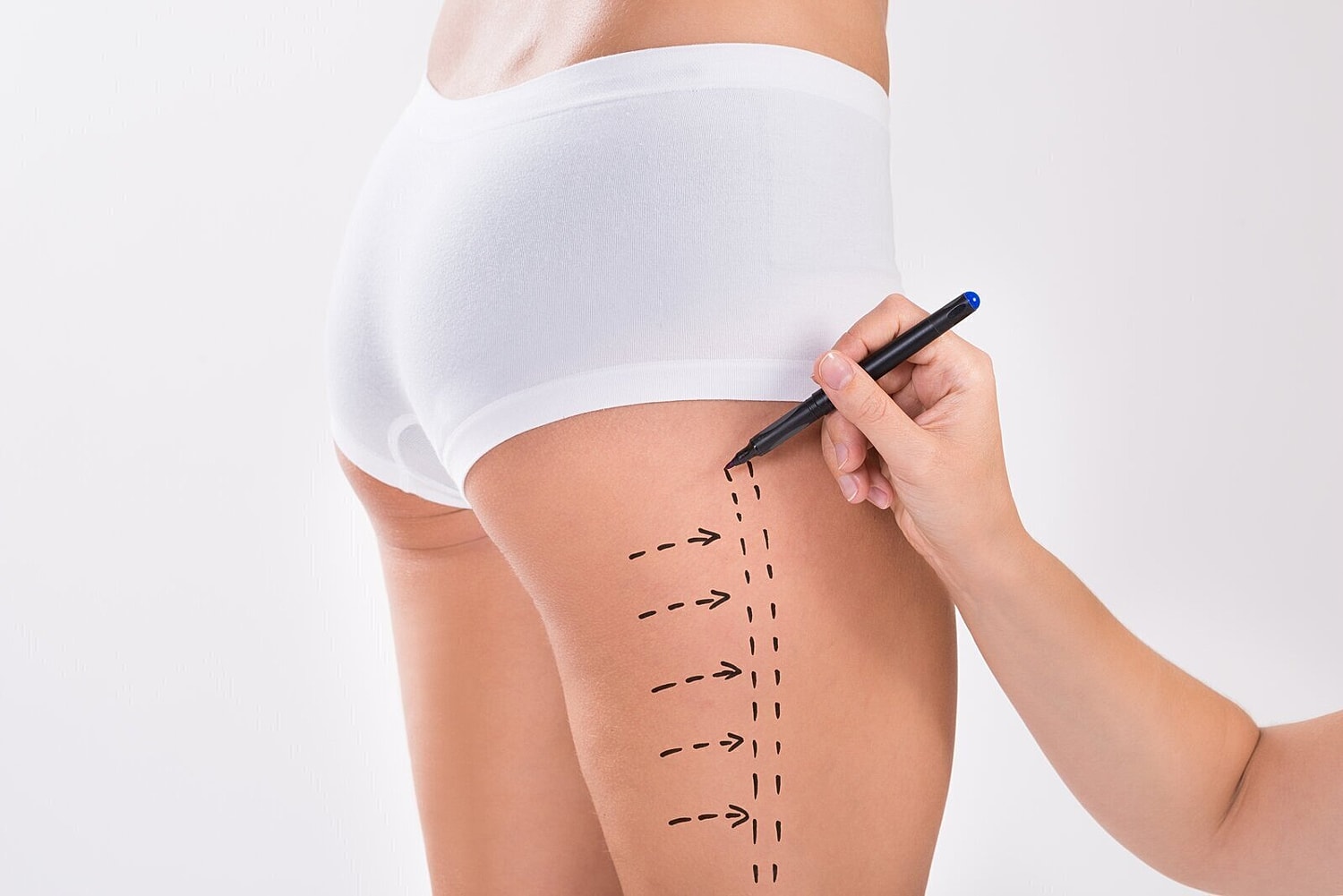 The Benefits Of Thigh Lift Surgery