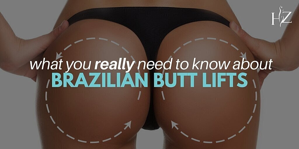 What You Really Need To Know About Brazilian Butt Lifts