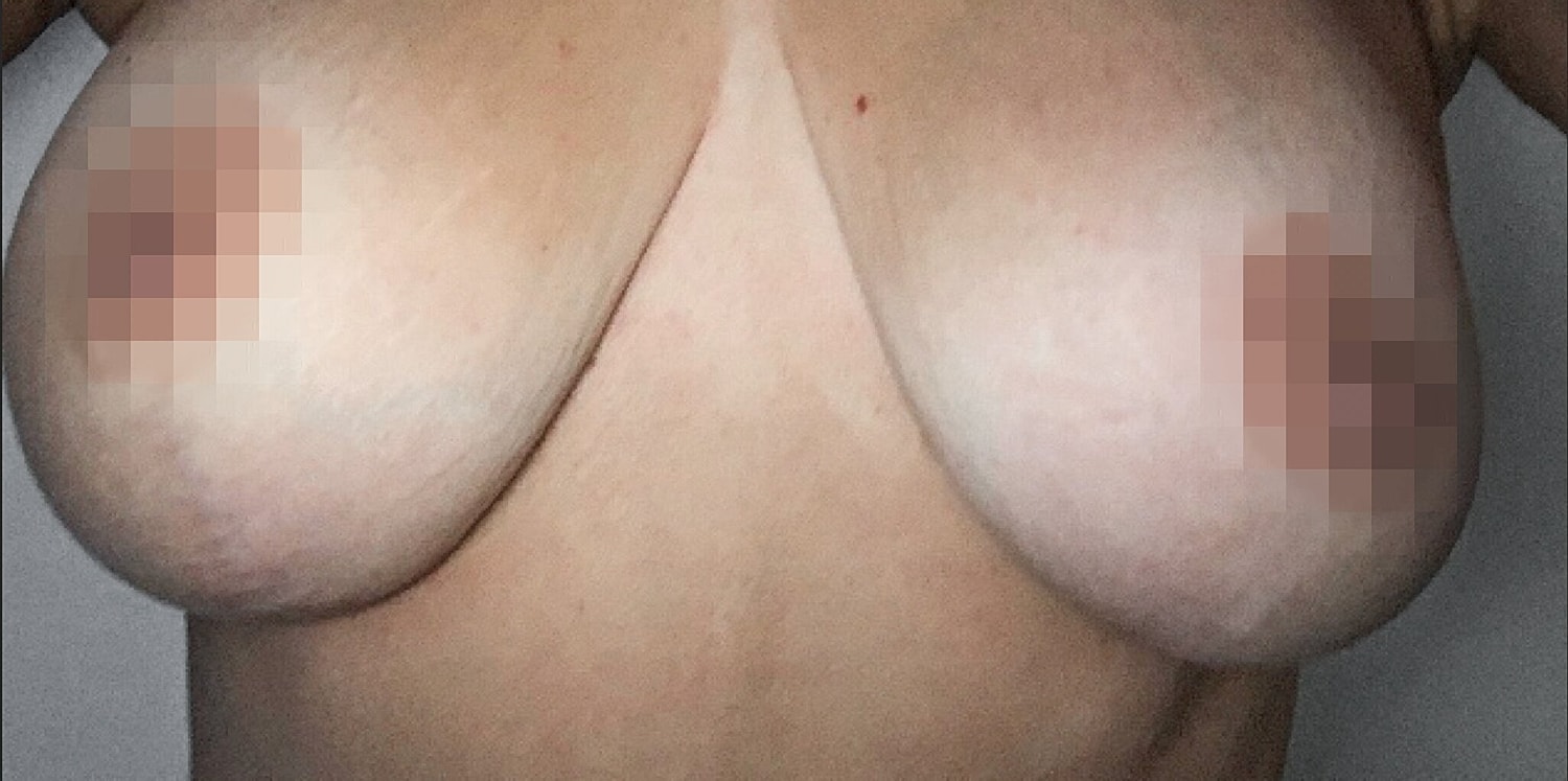 Image of a person's chest covered with blur.