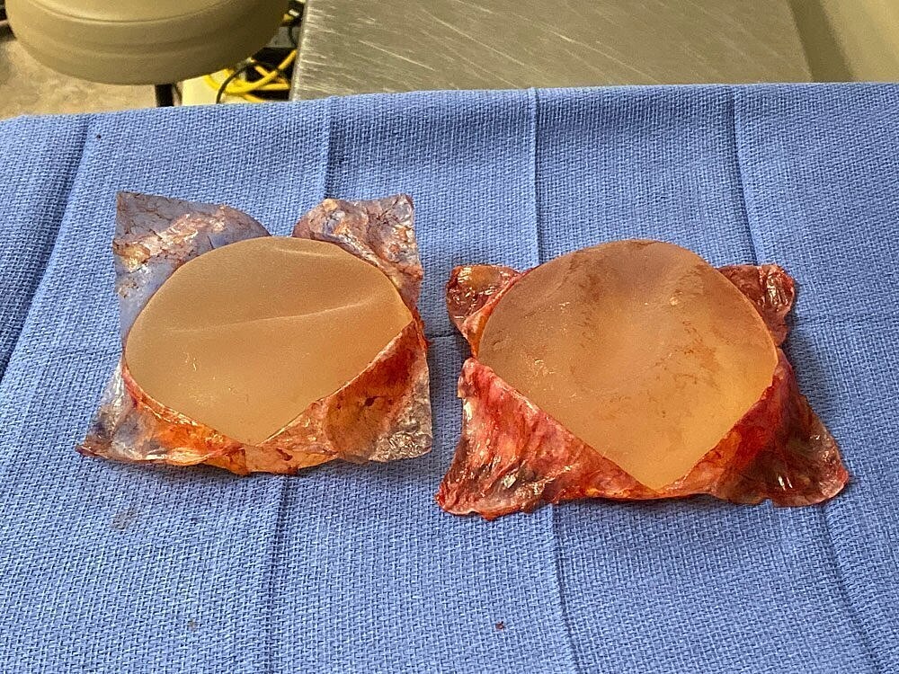 Two gelatinous molds on blue cloth backdrop
