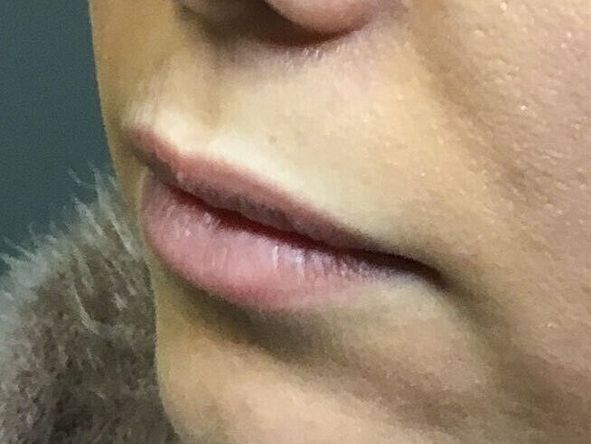 Close-up of lips and skin texture.