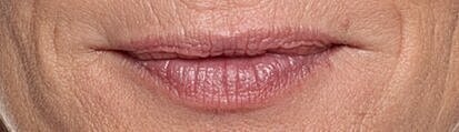 Close-up of textured, aged lips.