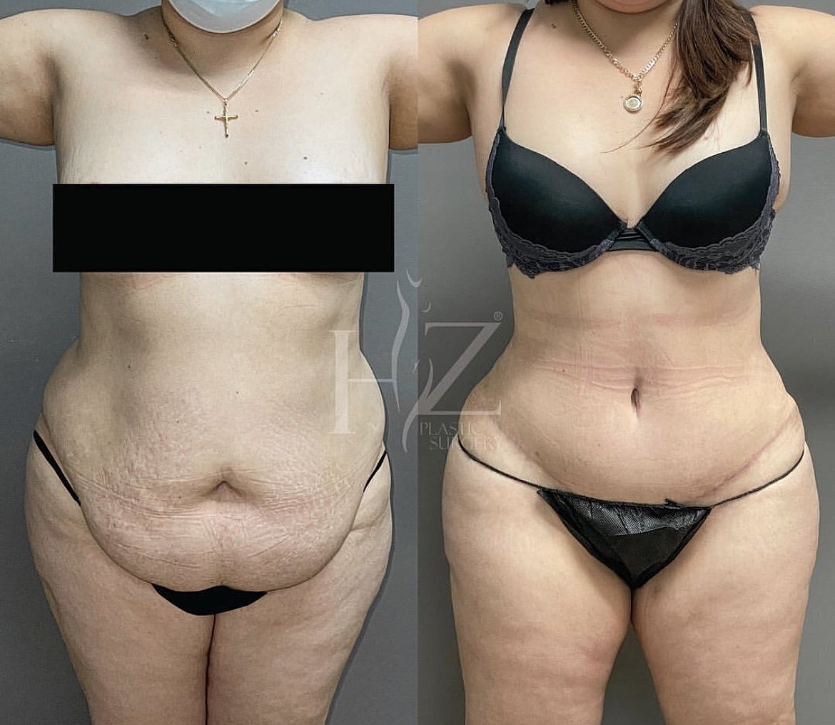 Before and after body transformation photos.