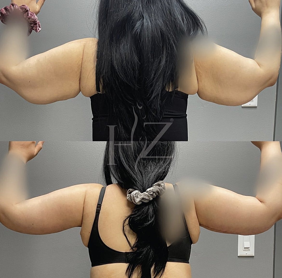 Fitness transformation showcasing strong arms and back.