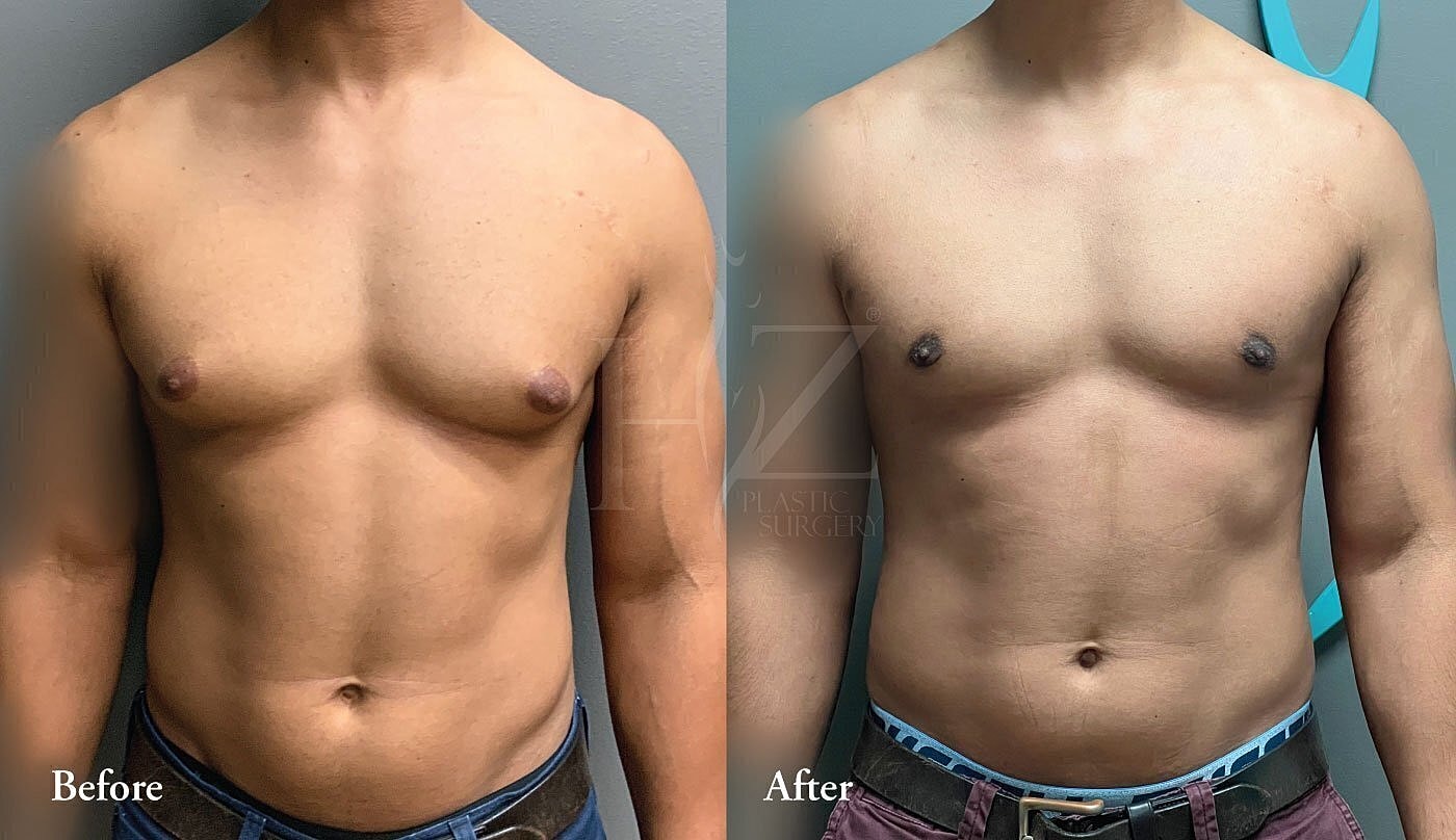 Before and after photos of body transformation.