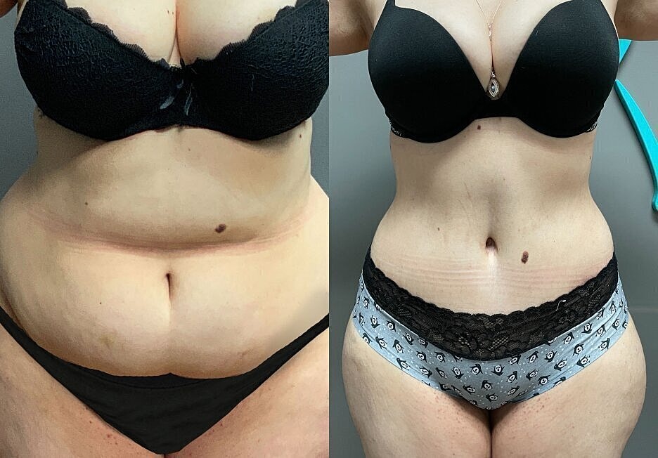 Body transformation before and after photos.