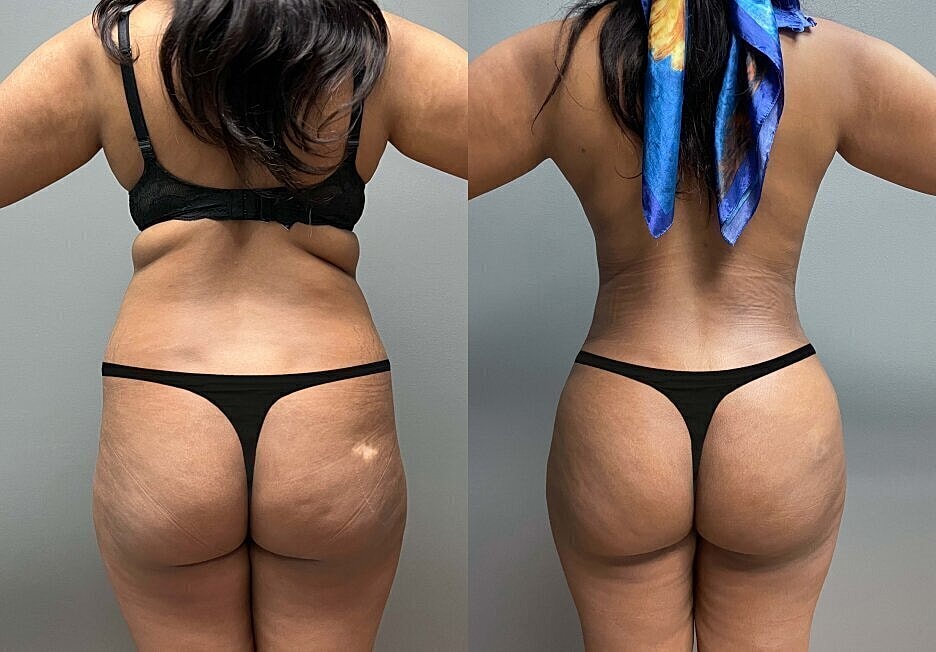 Body transformation before and after images.