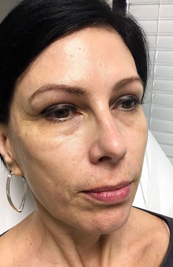 Close-up of woman's face with neutral expression.