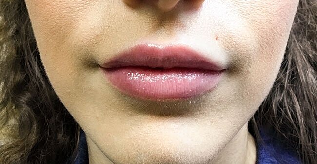 Close-up of smooth, glossy lips.