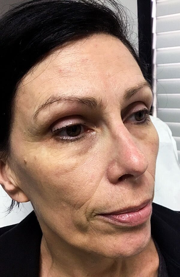 Close-up of a woman's face showcasing features.