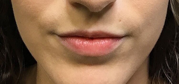 Close-up of lips with natural shine.