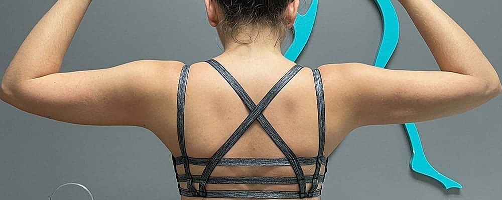 Liposuction Arms Before & After