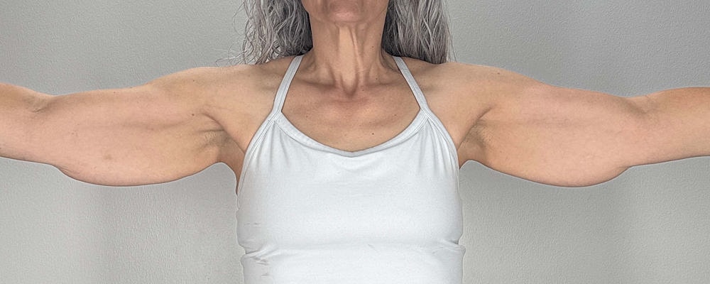 Arm Lift Before & After