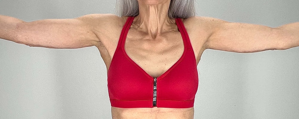 Arm Lift Before & After