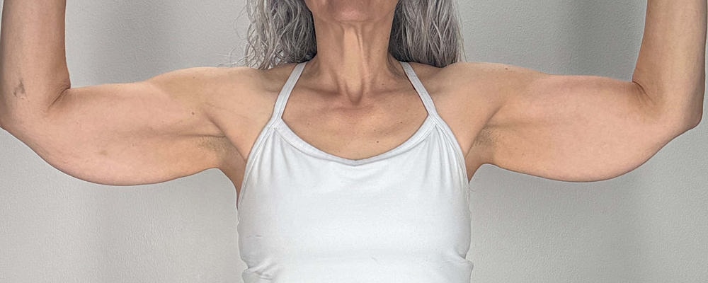 Arm Lift Before & After