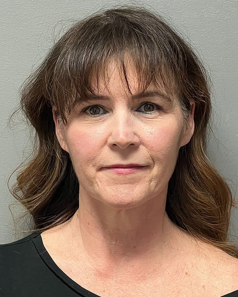 Facelift Before & After