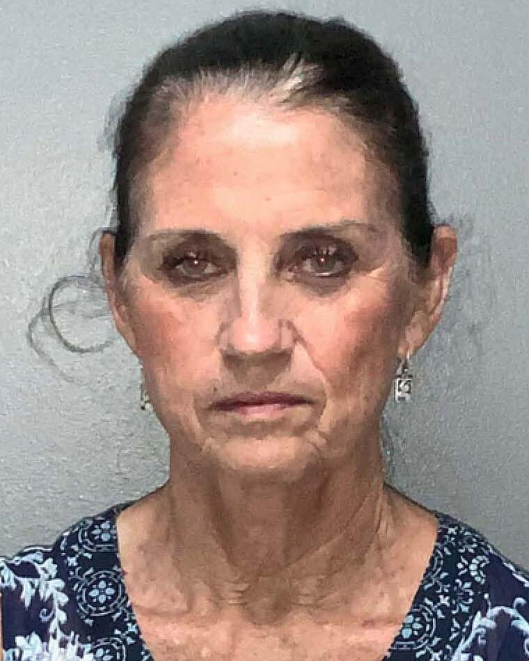 Facelift Before & After