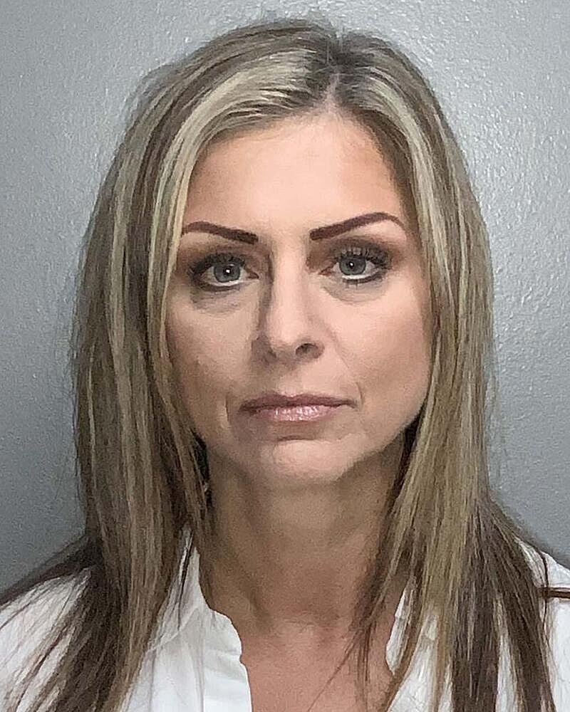 Facelift Before & After