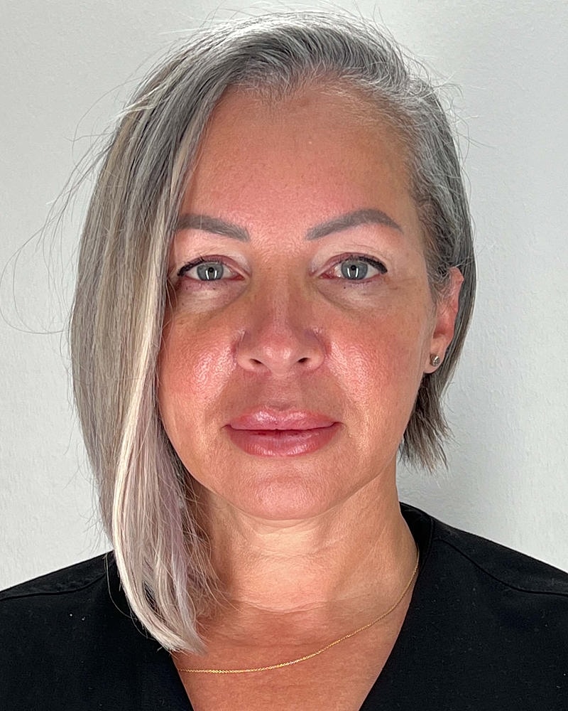 Facelift Before & After