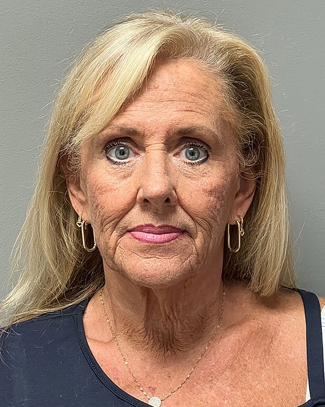 Facelift Before & After