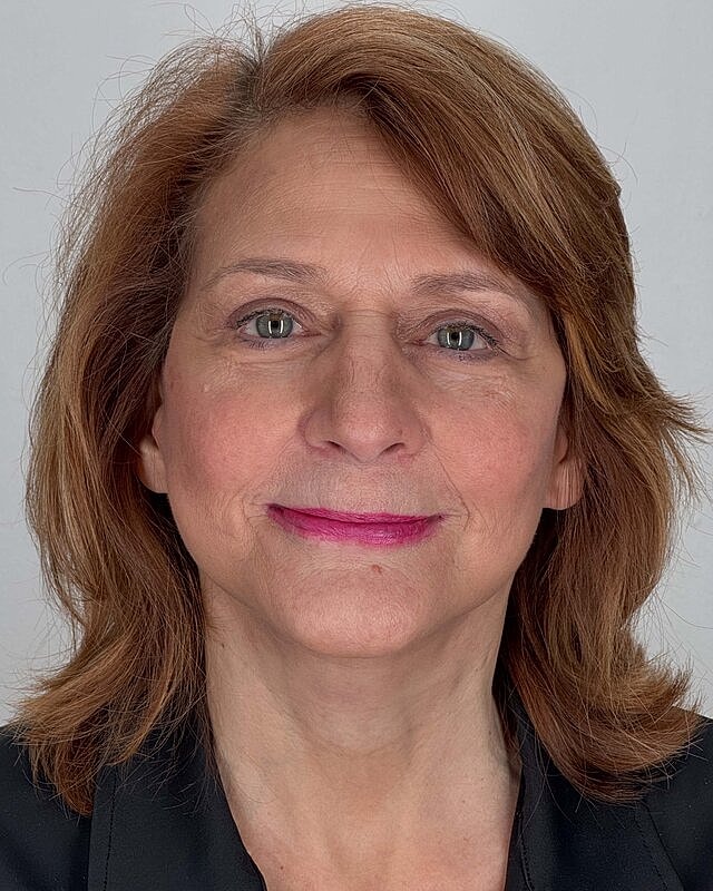 Facelift Before & After
