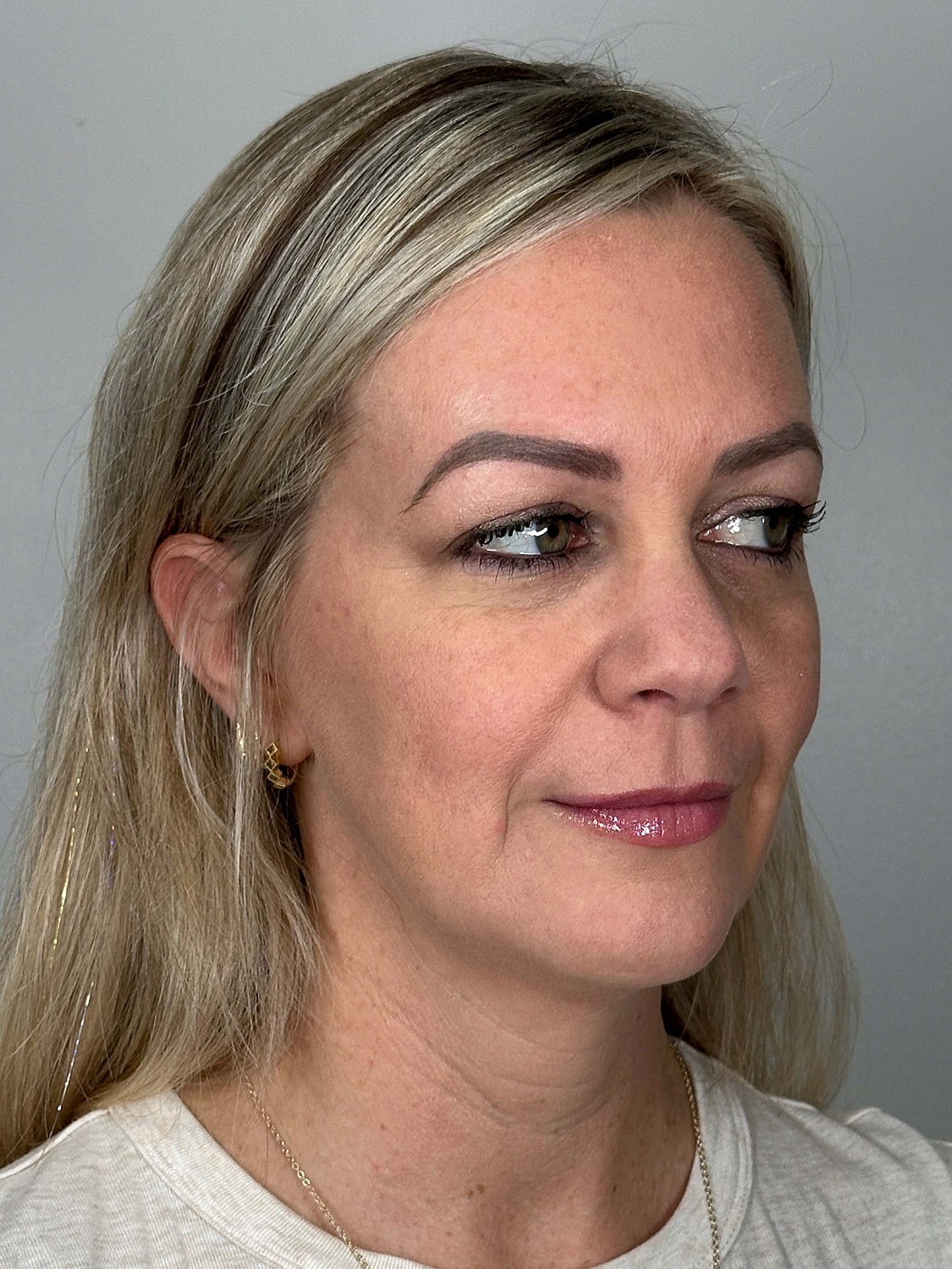 Facial Balancing Before & After