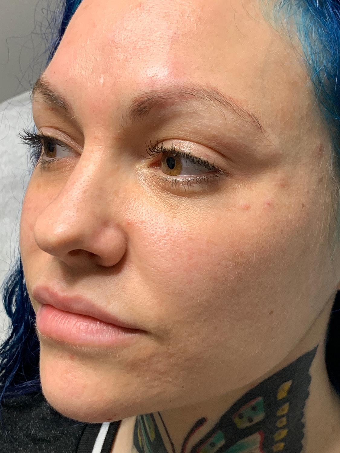 Facial Balancing Before & After