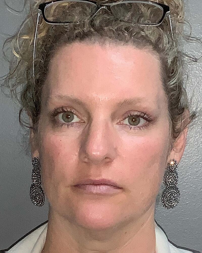 Blepharoplasty Before & After