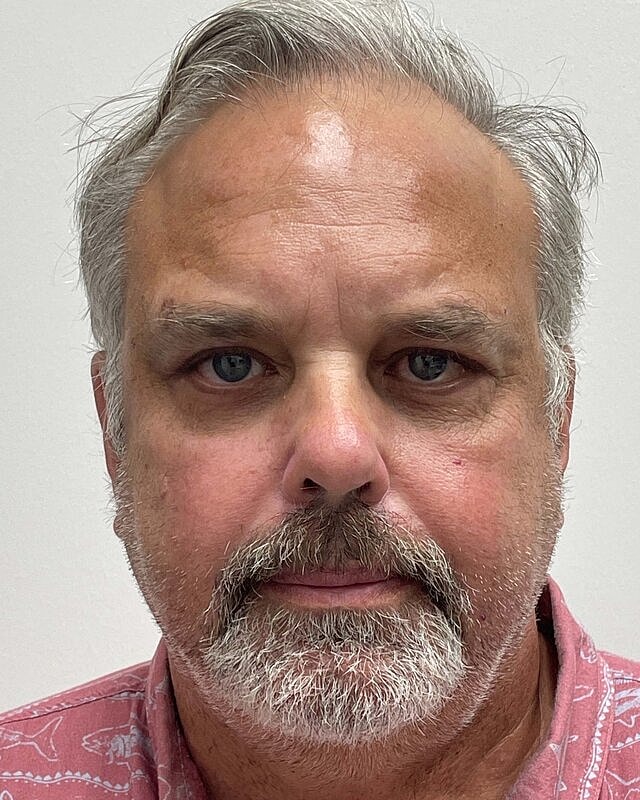 Blepharoplasty Before & After
