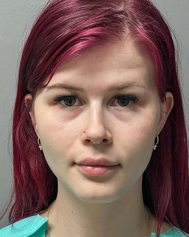 Blepharoplasty Before & After