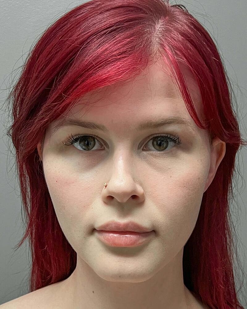 Blepharoplasty Before & After