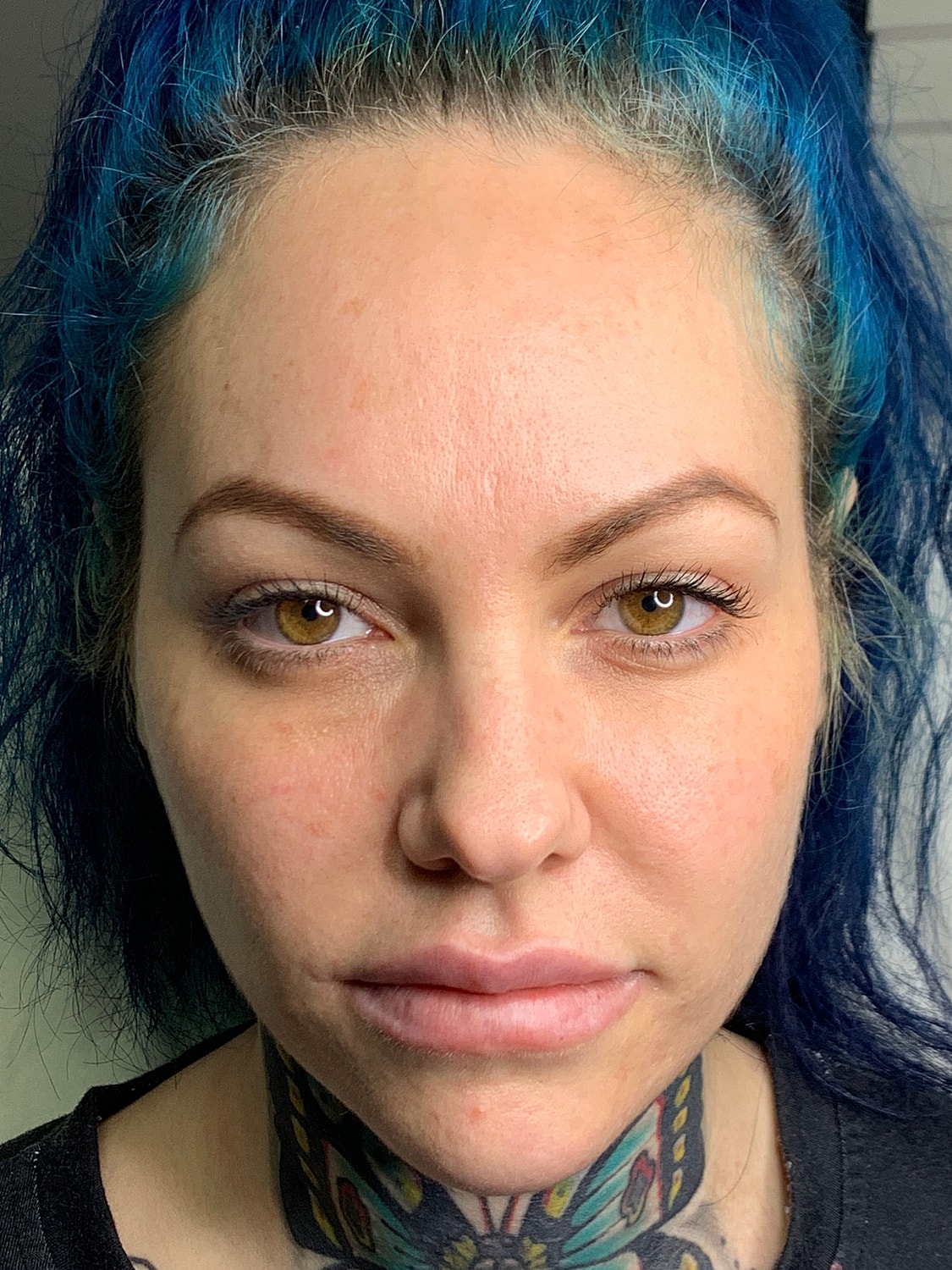 Facial Balancing Before & After