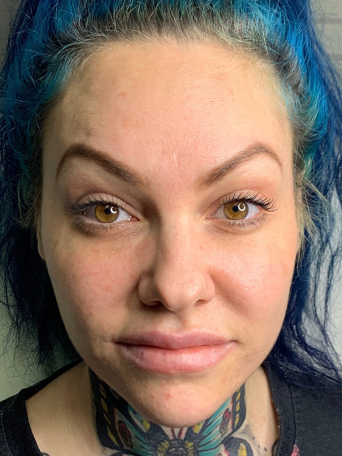 Facial Balancing Before & After