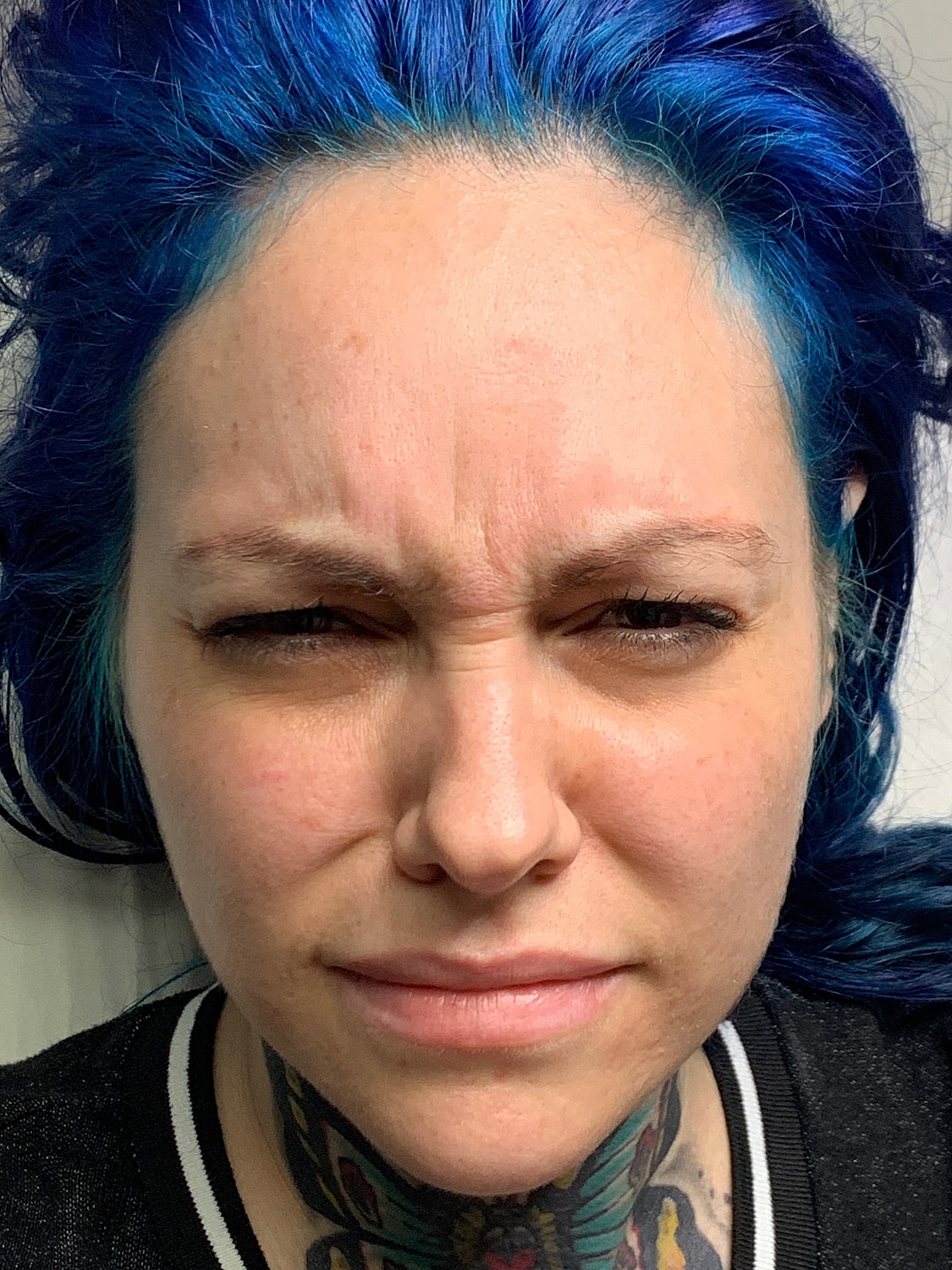 Facial Balancing Before & After