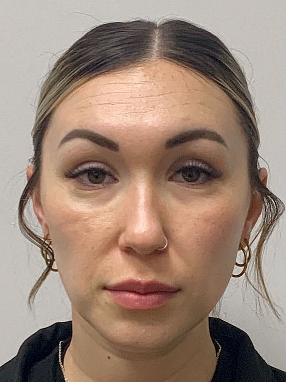 Wrinkle Treatments Before & After