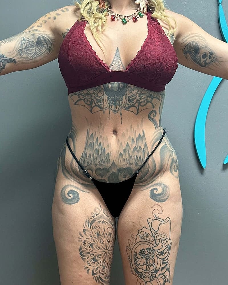 Liposuction Midsection Before & After