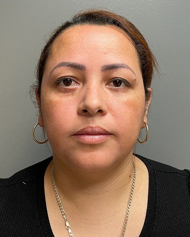 Chin Liposuction Before & After