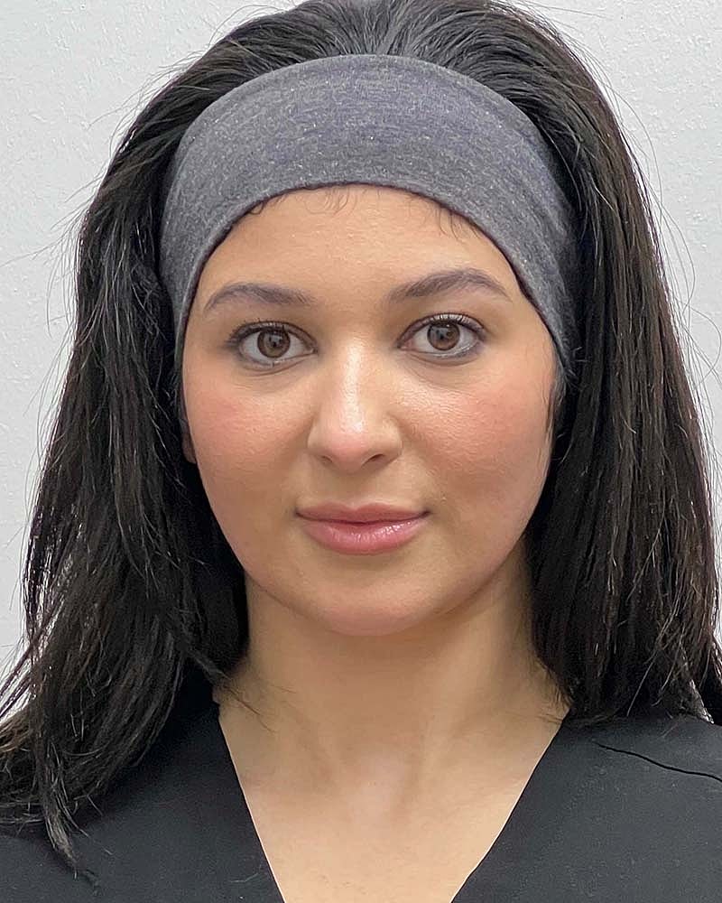 Chin Liposuction Before & After