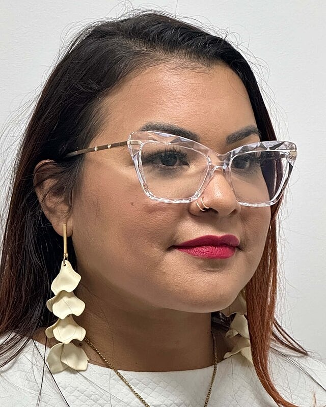 Chin Liposuction Before & After