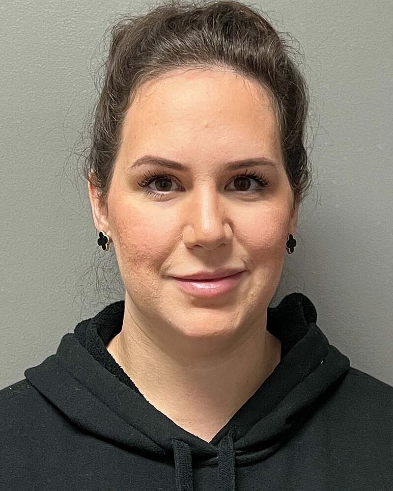 Chin Liposuction Before & After