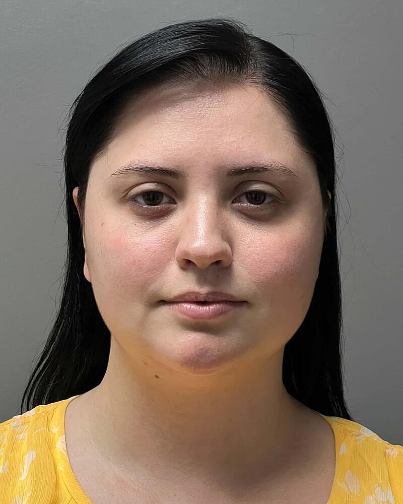 Chin Liposuction Before & After