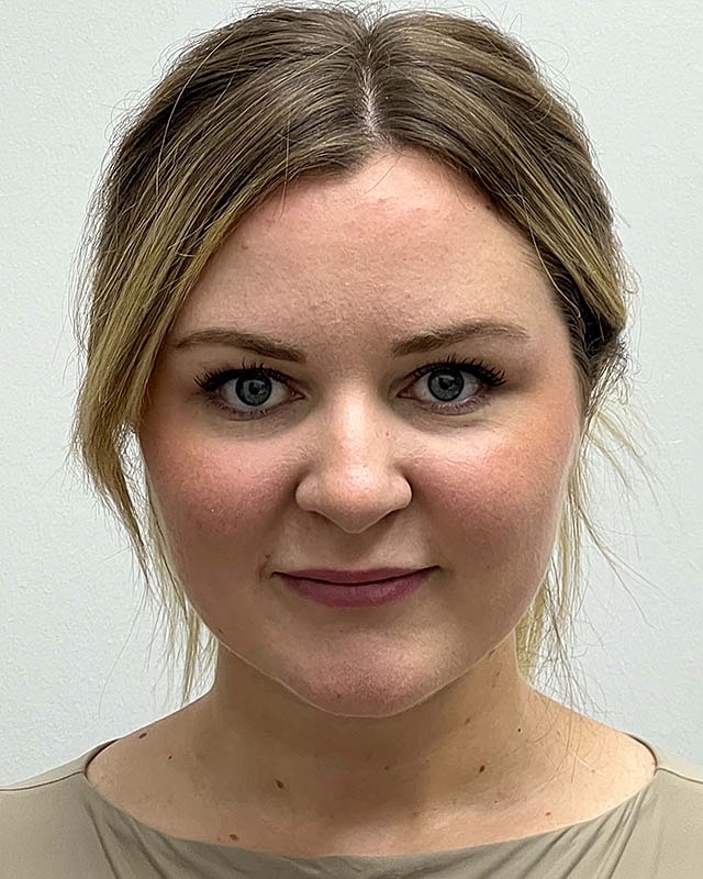 Chin Liposuction Before & After