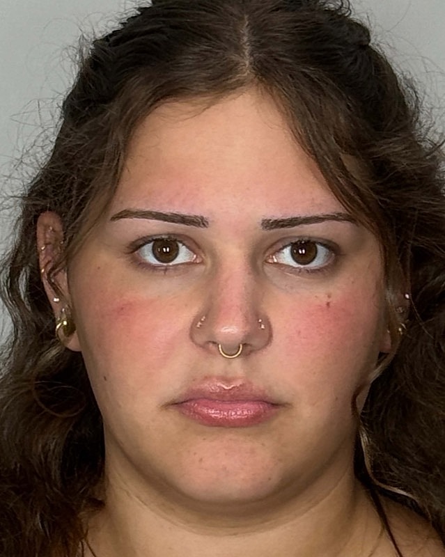Juvederm Before & After