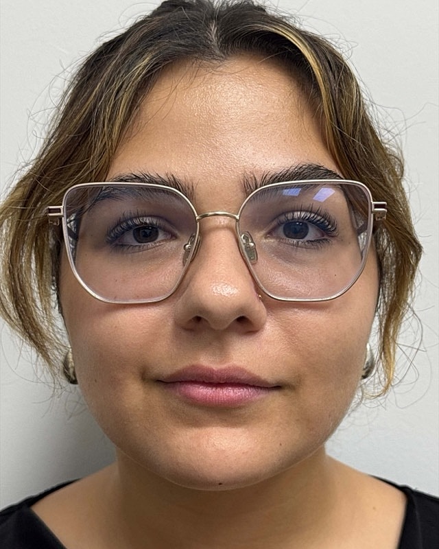 Juvederm Before & After