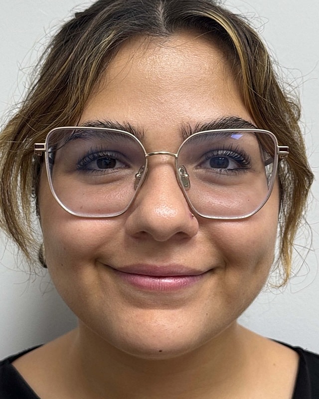 Juvederm Before & After