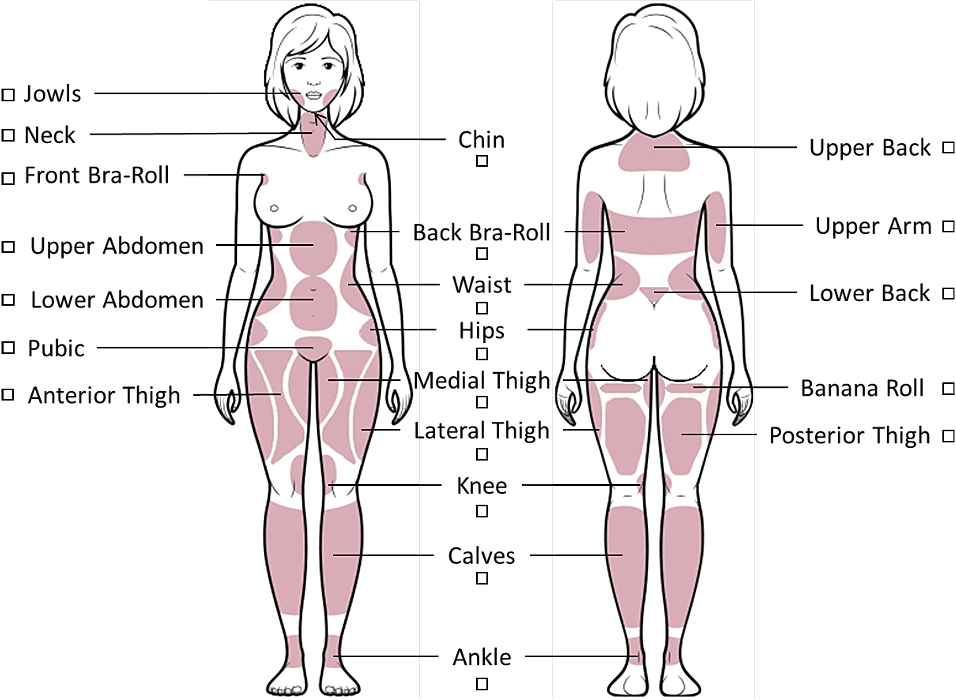 Body diagram highlighting different fat areas.